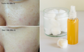 Thần kỳ hỗn hợp giúp se lỗ chân lông, dưỡng da sáng trắng mịn màng