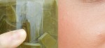 Mụn Nhiều Đến Đâu, Cứ Áp Dụng Cách Sau Sẽ Khỏi