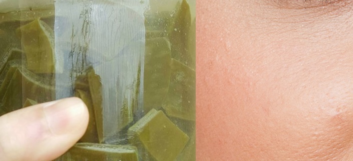 Mụn Nhiều Đến Đâu, Cứ Áp Dụng Cách Sau Sẽ Khỏi