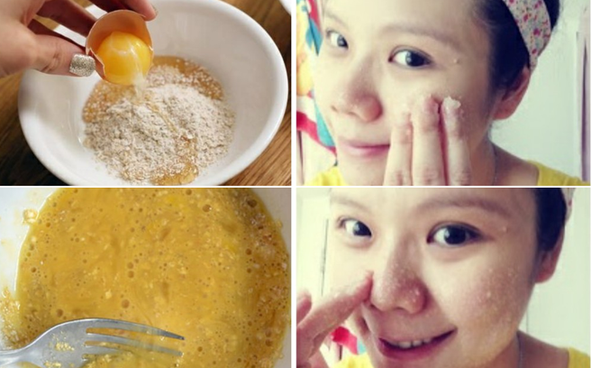 4 công thức mặt nạ tự nhiên giúp loại bỏ mụn cấp tốc đón Tết