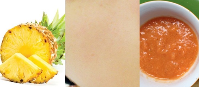 Da trắng bất ngờ sau 15 phút thoa hỗn hợp này