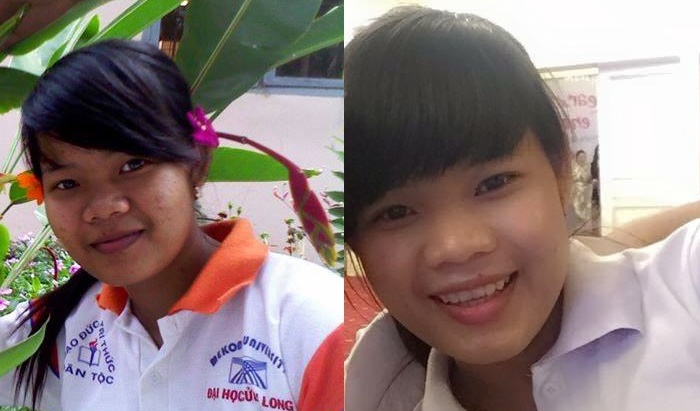 “ĐỪNG BUỒN KHI LÀN DA CỦA BẠN XẤU XÍ VÀ NHIỀU KHUYẾT ĐIỂM”