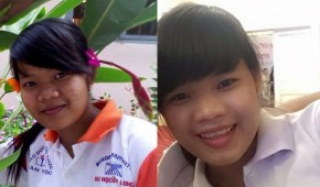 “ĐỪNG BUỒN KHI LÀN DA CỦA BẠN XẤU XÍ VÀ NHIỀU KHUYẾT ĐIỂM”