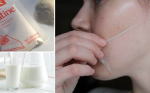 Bong cả mụn đầu đen chĩ trong 15 phút với hỗn hợp đặc biệt có giá chưa đến 2k