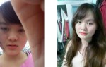 Mẹo trị tàn nhang bằng rượu gạo của cô nàng 9X