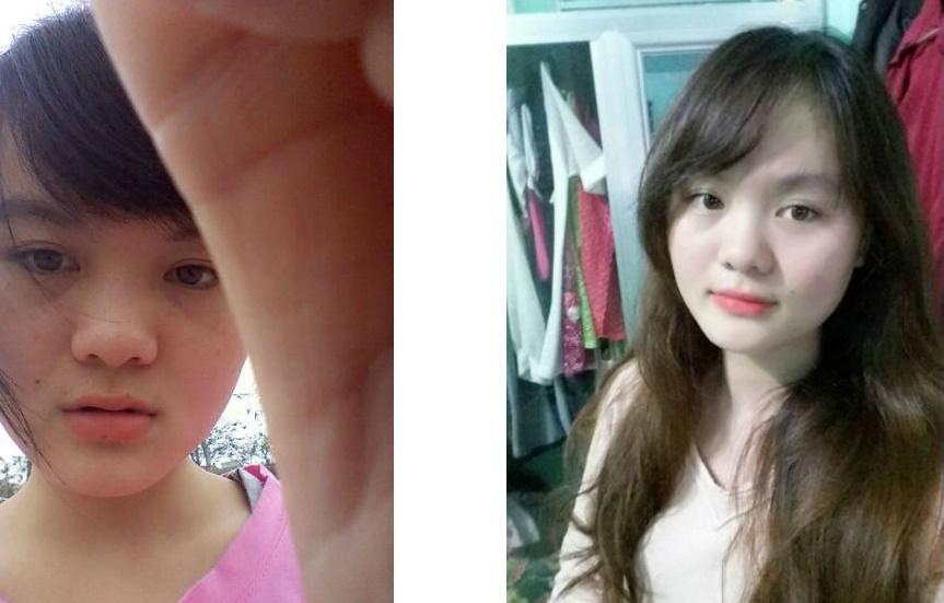 Mẹo trị tàn nhang bằng rượu gạo của cô nàng 9X