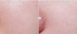 8 Cách tự nhiên xóa sạch lỗ chân lông to trên da vĩnh viễn