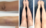 Mẹo hay cho khuỷu tay, đầu gối luôn trắng mịn thần kỳ