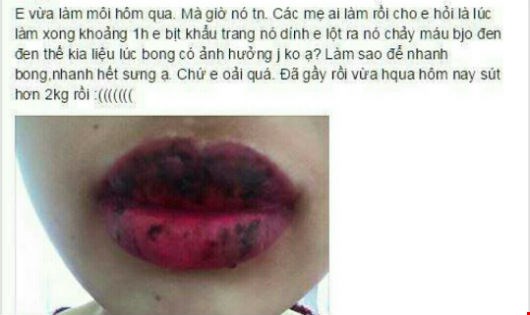 Cẩn trọng với dịch vụ làm đẹp “lưu động” đón Tết