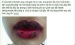 Cẩn trọng với dịch vụ làm đẹp “lưu động” đón Tết