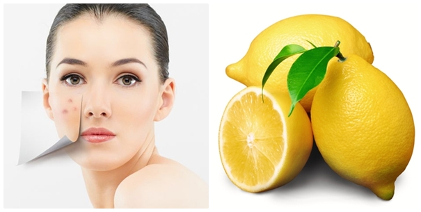 Cách trị thâm mụn hiệu quả cho bạn gái sẵn sàng đón Tết