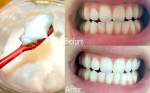 Trị mụn, trắng răng với muối cực đơn giản, bạn đã thử chưa?