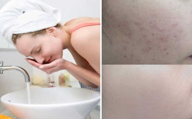 Nguyên liệu thần thánh chỉ rửa mặt da cũng trắng mịn sạch mụn!