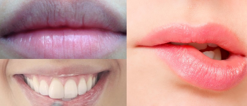 Biến môi thâm sì thành hồng hào căng mọng trong tích tắc
