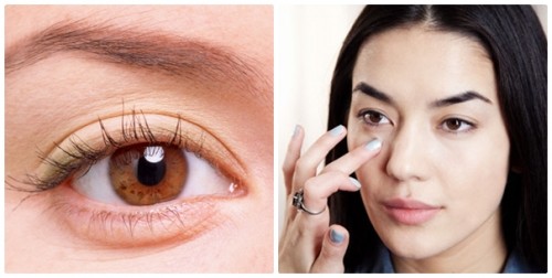 7 bí quyết chữa “bọng mắt” không thể dễ dàng hơn