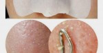 Các bí quyết trị mụn đầu đen tại nhà trong vòng 5 phút lại không hề tốn kém