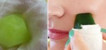 Mờ sẹo thâm mà không cần phải dùng loại thuốc nào?