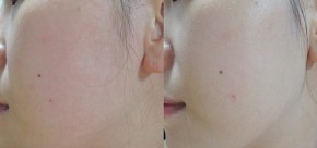 Dưỡng trắng da tại nhà siêu tốc hiệu quả còn hơn cả kem lột da