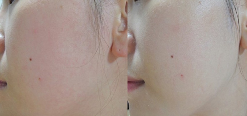 Dưỡng trắng da tại nhà siêu tốc hiệu quả còn hơn cả kem lột da