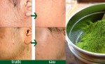 Học Phụ Nữ Ấn Độ Triệt Lông Tại Nhà, 3 Tháng Mới Mọc Lại