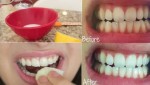 Chà nguyên liệu này trong 5 phút bạn sẽ có ngay hàm răng trắng sáng vạn người mê