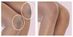 Loại Bỏ Da Chết Ở Khuỷu Tay Và Đầu Gối Với Những Cách Sau Đây