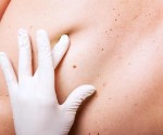 Xuất hiện 10 dấu hiệu này chị em phải gặp bác sỹ ngay kẻo thành giai đoạn cuối