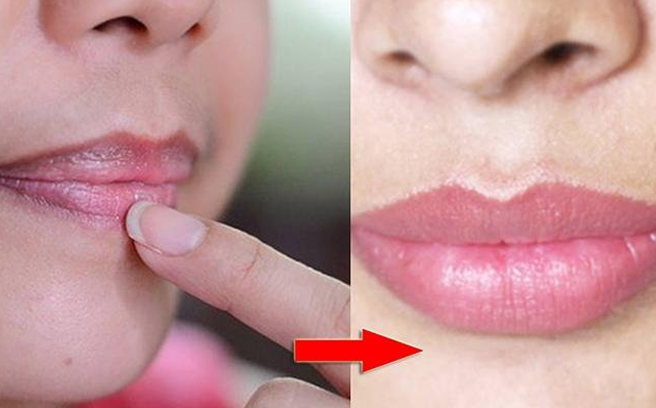 Mẹo hay tự nhiên giúp trị thâm môi cực hiệu quả đừng bỏ qua