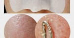 Cách loại bỏ mụn đầu đen nhờ 4 nguyên liệu ngày nào cũng ăn