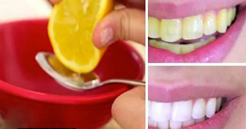 Dùng nước cốt chanh làm răng trắng sáng hiệu quả chỉ sau hai phút