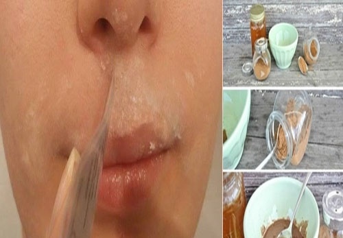 Công thức tự nhiên làm vài lần là tẩy sạch ria mép vĩnh viễn