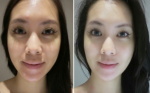 Cách để có làn da hồng hào tự nhiên không cần trang điểm