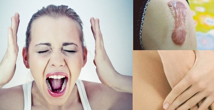 CHỮA CHÁY 10 VẤN ĐỀ SỨC KHỎE MÀ PHỤ NỮ HAY GẶP PHẢI