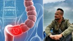 Dấu Hiệu Nhận Biết Căn Bệnh Ung Thư Đã Cướp Đi Nhạc Sĩ Trần Lập