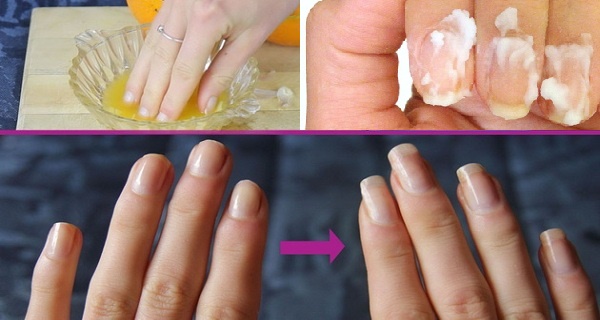 Mẹo hay và rẻ tiền chữa trị móng tay khô, giòn dễ gãy
