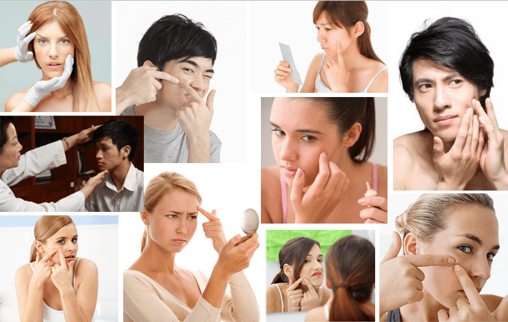 Bạn có biết mình đang bị loại mụn gì không?