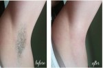 Không cần nhổ lông nách cũng bị đánh bay với phương pháp đơn giản này