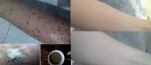 Em đã lấy lại làn da trắng mịn sau khi bị sạm đen rồi chị em ạ!