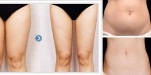 Cách triệt mỡ bụng và mỡ đùi cấp tốc giảm hơn 3 cm trong 1 tuần