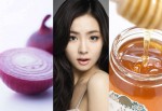 Trị mụn trứng cá bằng hành tây, bạn đã thử chưa?