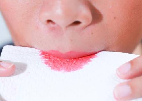 Bày mẹo tô son môi lâu phai và đẹp tự nhiên dành cho các nàng “gà mờ”