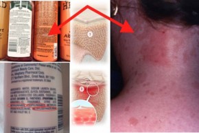 Tuyệt đối không mua dầu gội chứa 6 thành phần gây ung thư này