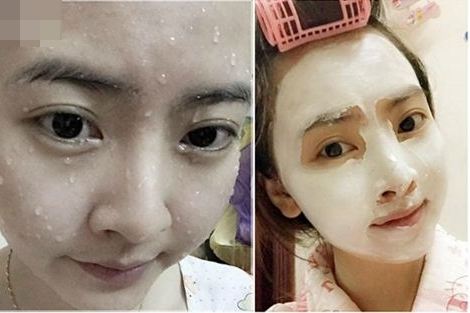 Vừa trị mụn ẩn tận gốc, vừa dưỡng da trắng sáng chỉ bằng 1 nguyên liệu cực rẻ