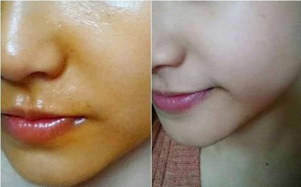 Một công thức duy nhất đặc trị da sạm, da đen chỉ trong 5 ngày