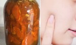 Có lọ "thần dược" này trong tay, da sẽ trắng mịn và không một vết thâm nám