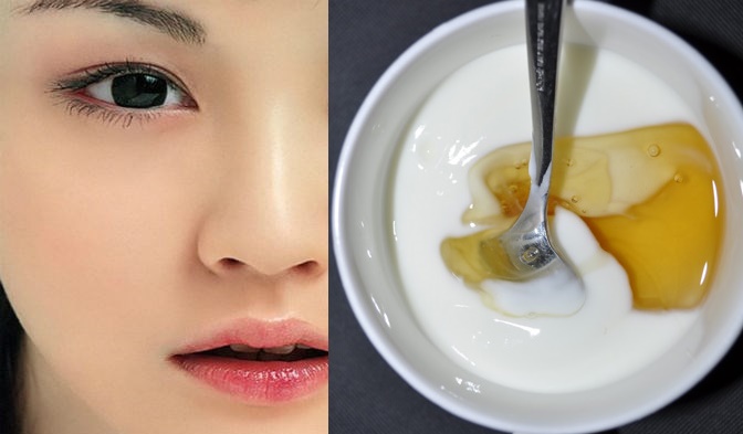 Cùng tôi trị vết thâm do mụn trong 2 tuần nhờ mẹo nhỏ của mẹ tôi