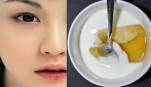 Cùng tôi trị vết thâm do mụn trong 2 tuần nhờ mẹo nhỏ của mẹ tôi