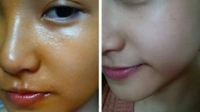Một công thức duy nhất làm 5 ngày dù ăn nắng vẫn trắng
