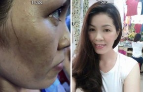9/10 chị em bôi hỗn hợp này 2 lần/tuần có làn da trắng như bông bưởi