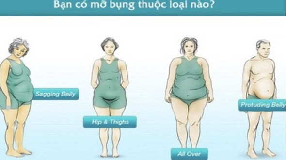 Hiểu 4 loại bụng mỡ và cách hô biến chúng thật nhanh chóng